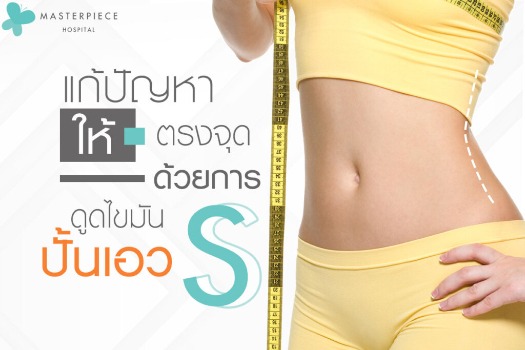 แก้ปัญหาให้ตรงจุดด้วยการ ดูดไขมันเอวเอส