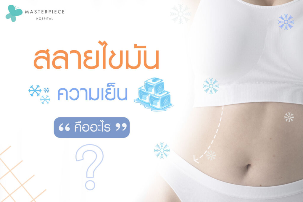 สลายไขมัน ด้วยความเย็น คืออะไร
