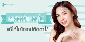 ตาสองชั้นหลบใน-แก้ได้ไม่ง้อเทปติดตา