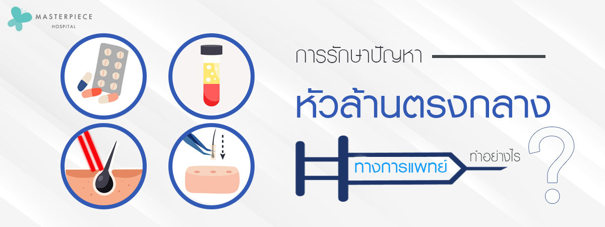 การรักษาปัญหาหัวล้านตรงกลางทางการแพทย์ การรักษาปัญหาหัวล้านตรงกลางทางการแพทย์