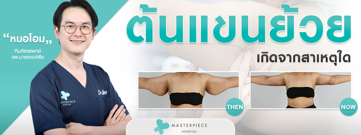 ต้นแขนย้วยเกิดจากสาเหตุใด