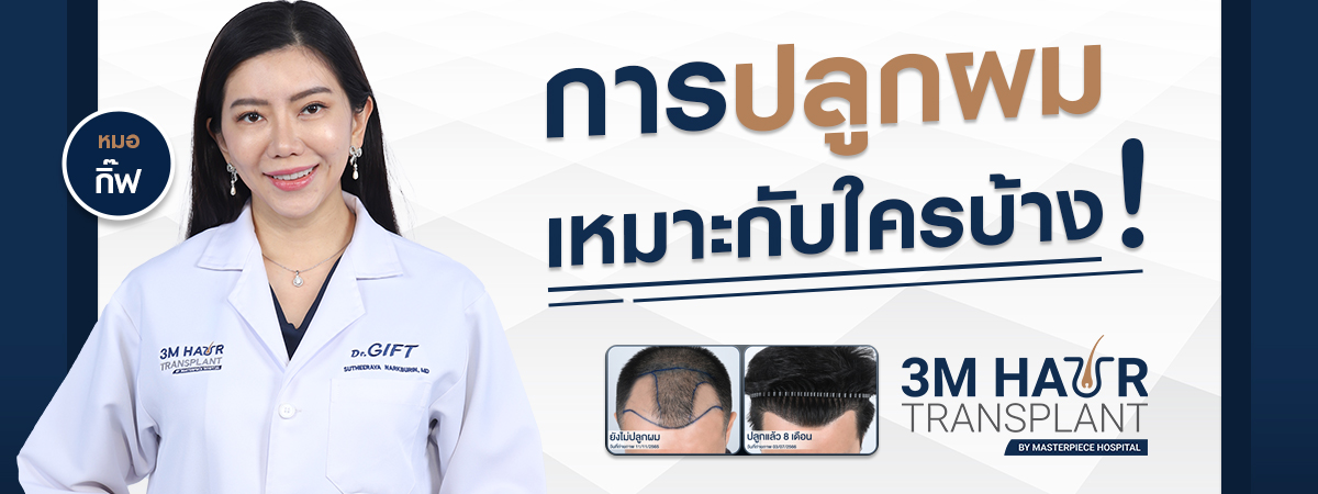 การปลูกผมเหมาะกับใครบ้าง