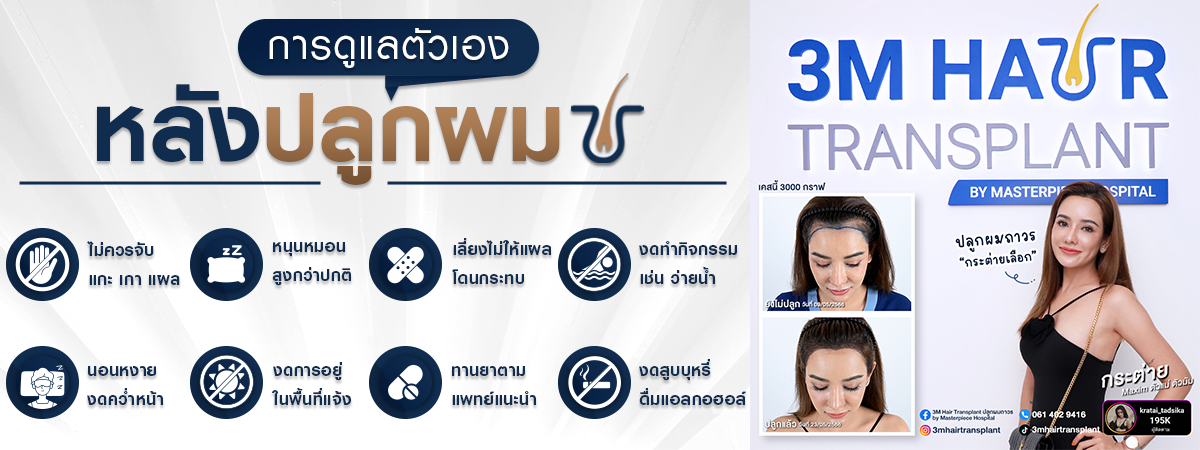 การดูแลตัวเองหลังปลูกผม