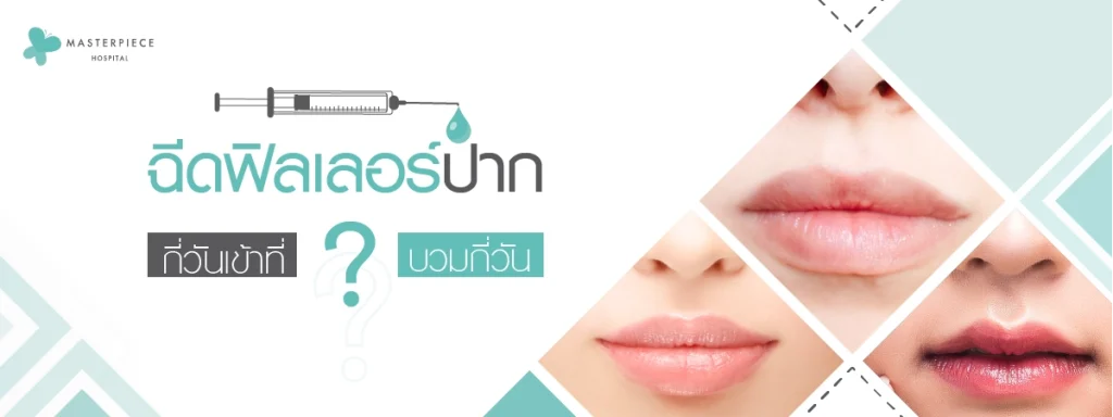 ฉีดฟิลเลอร์กี่วันเข้าที่ บวมกี่วัน