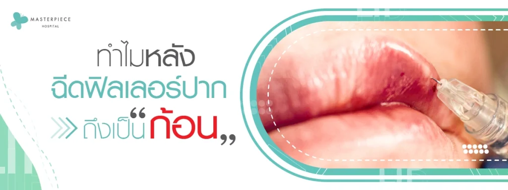 ทำไมหลังฉีดฟิลเลอร์ปากถึงเป็นก้อน