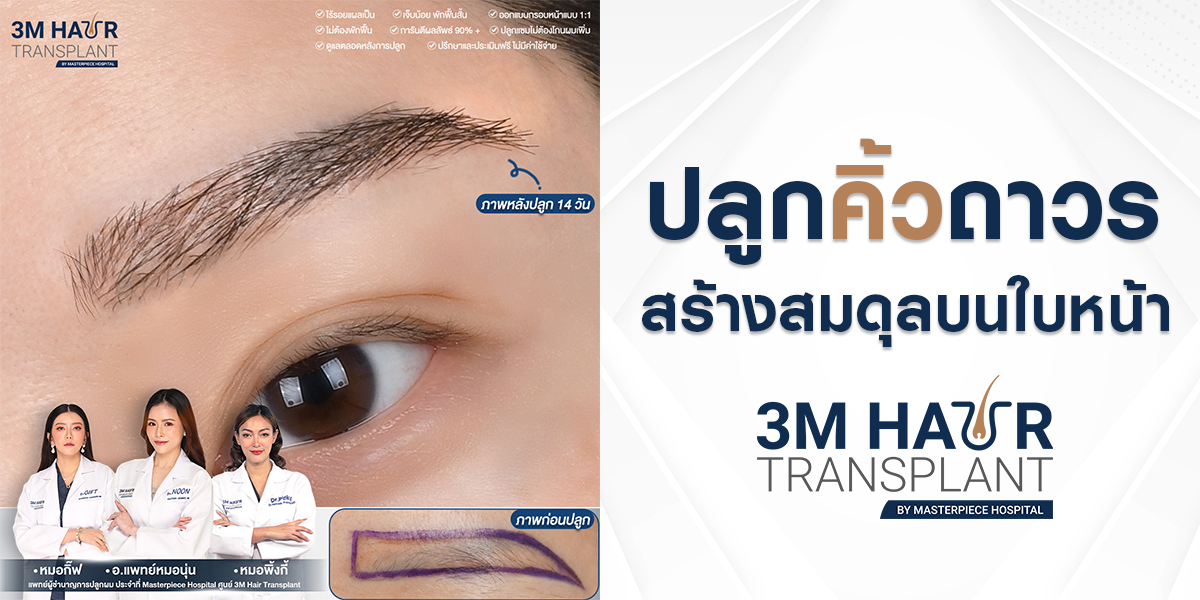 ปลูกคิ้วถาวร-สร้างสมดุลบนใบหน้า