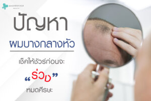 ปัญหา ผมบาง กลางหัวเช็คให้ชัวร์ก่อนจะร่วงหมดศีรษะ
