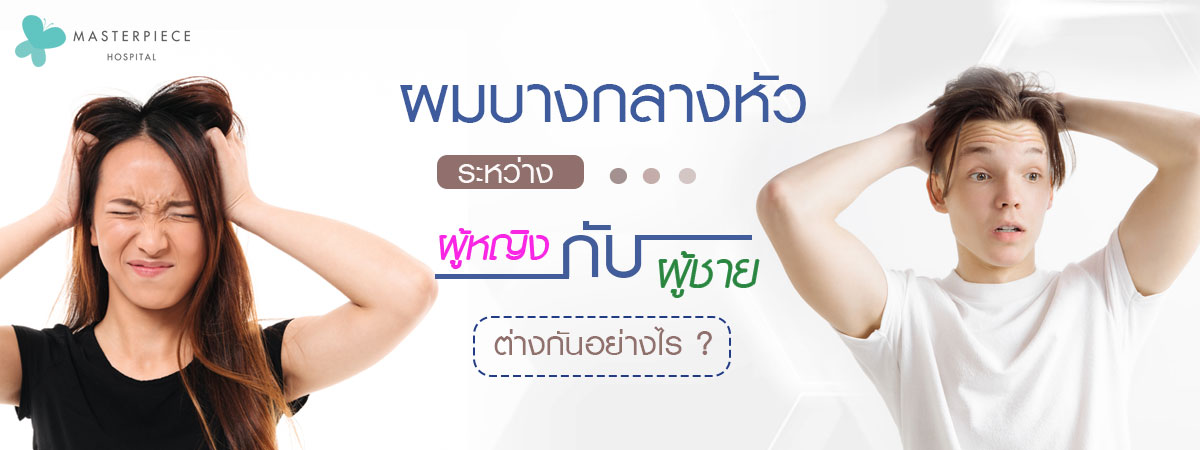 ผมบางกลางหัว ระหว่างผู้หญิงกับผู้ชายต่างกันอย่างไร 