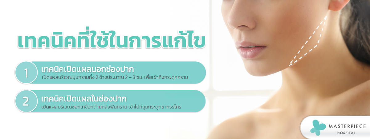 เทคนิคที่ใช้ในการแก้ไข