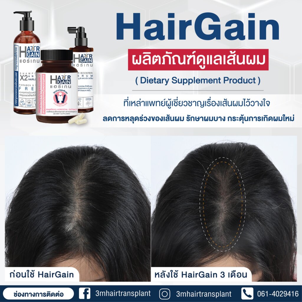 HairGain ผลิตภัณฑ์ดูแลเส้นผม