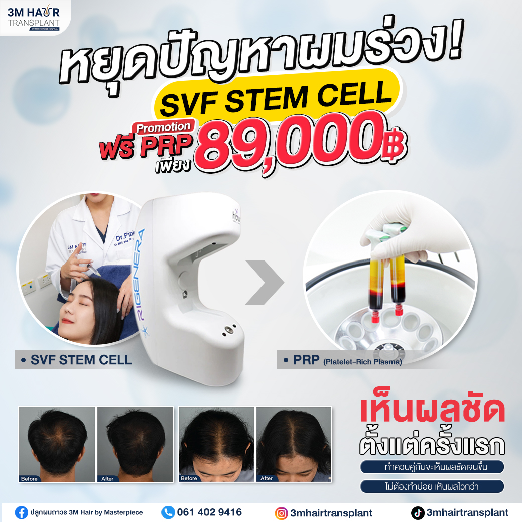 SVF STEM CELL