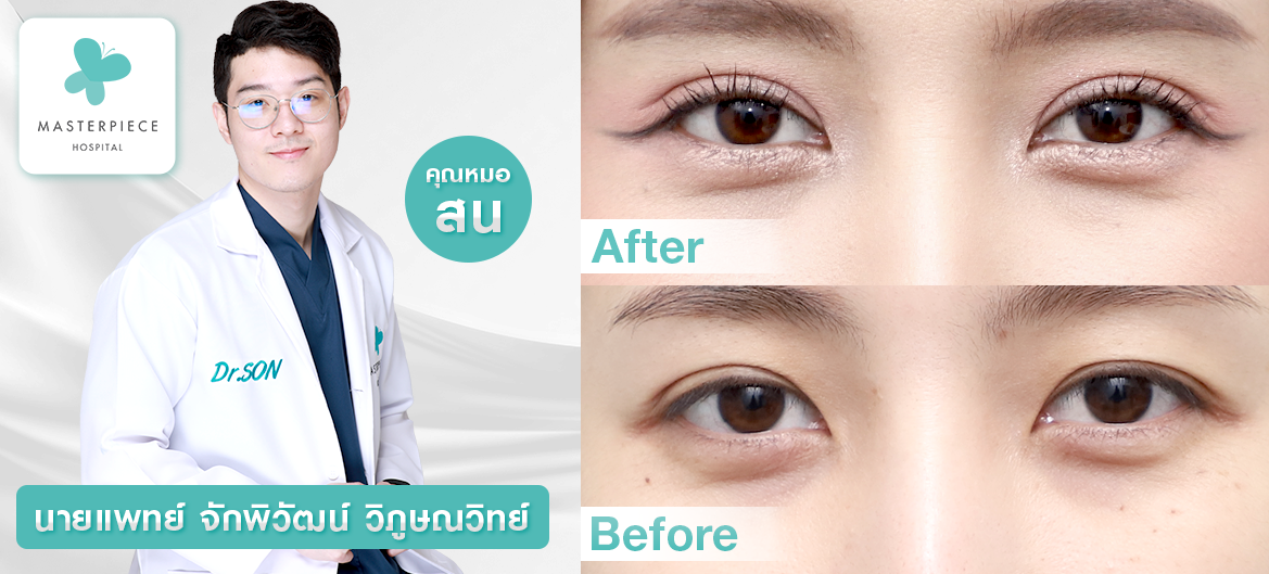 หมอศัลยกรรมตาเก่งที่สุดในไทย