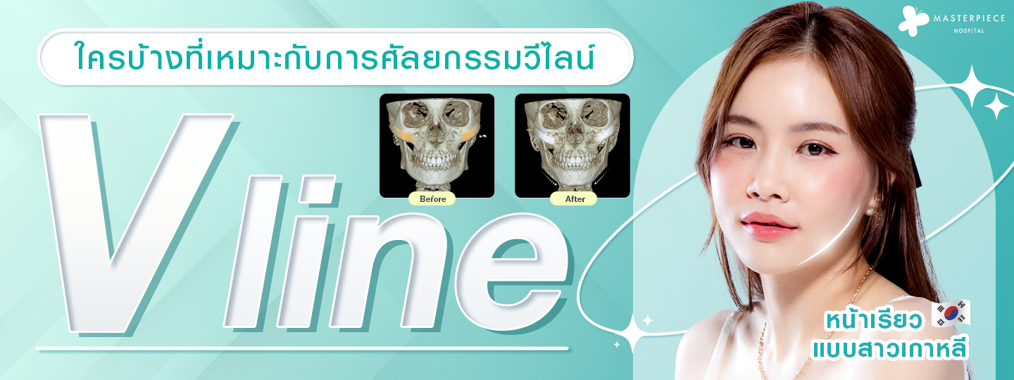 ใครบ้างที่เหมาะกับการศัลยกรรม V line