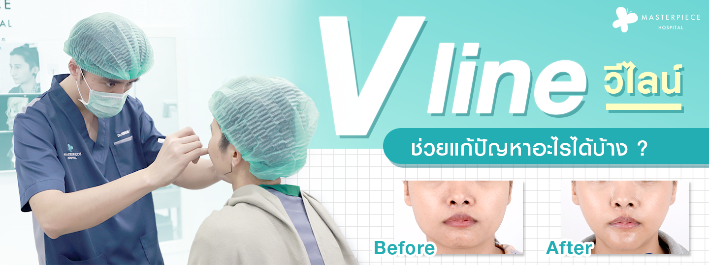 V line แก้ปัญหาอะไรได้บ้าง