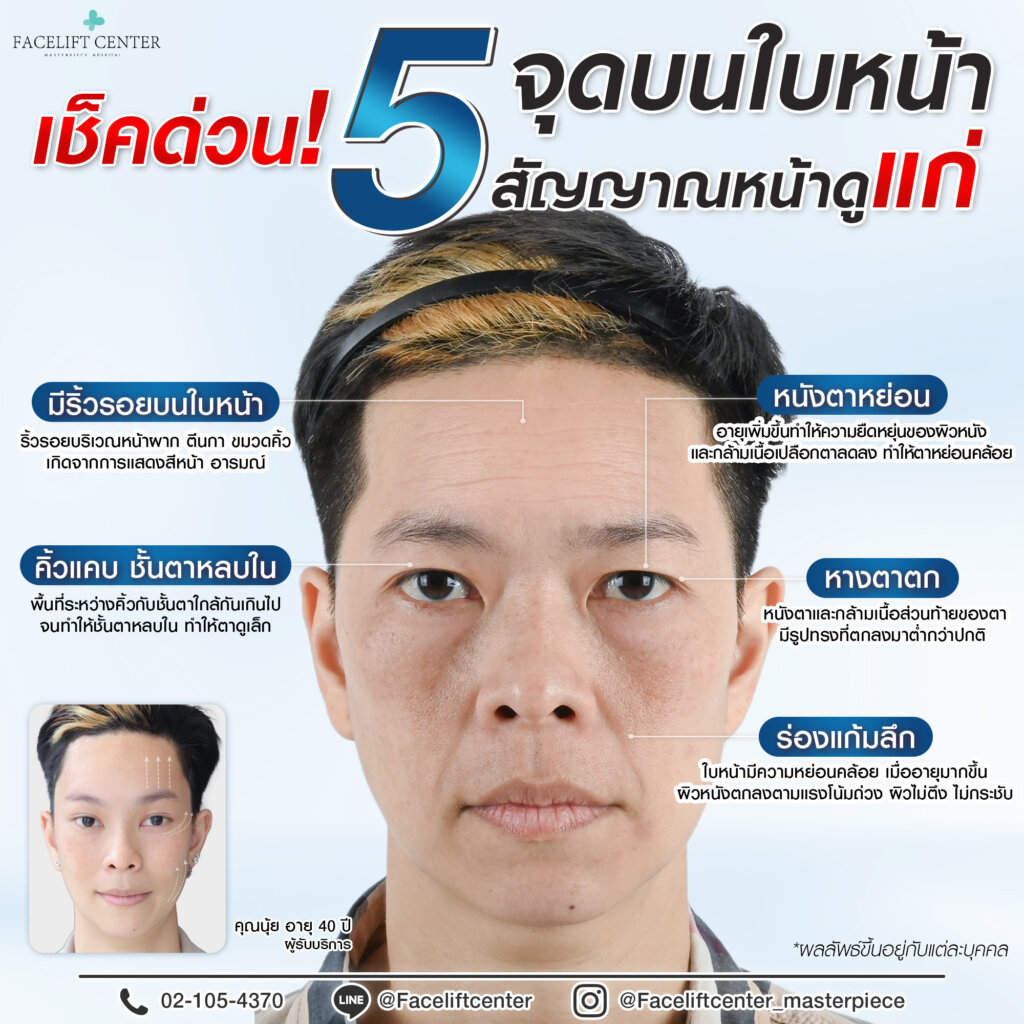 เช็คด่วน 5 จุดบนใบหน้าสัญญาณหน้าดูแก่ 