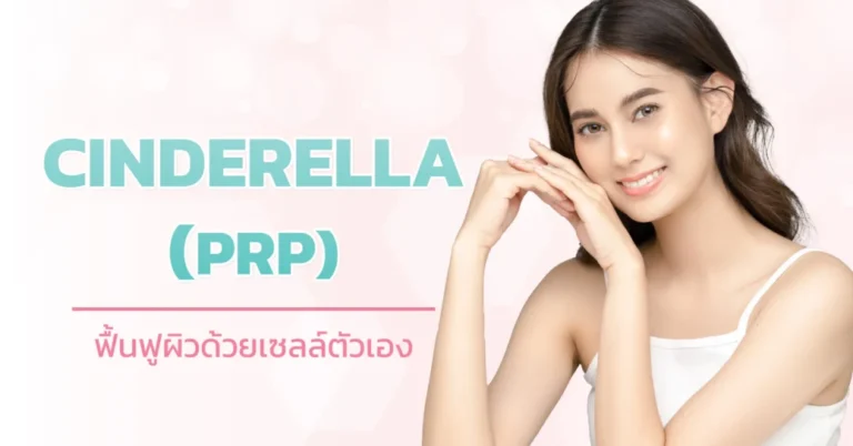 CINDERELLA-PRP