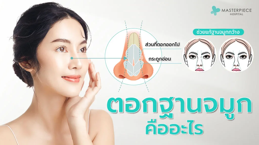 ตอกฐานจมูก