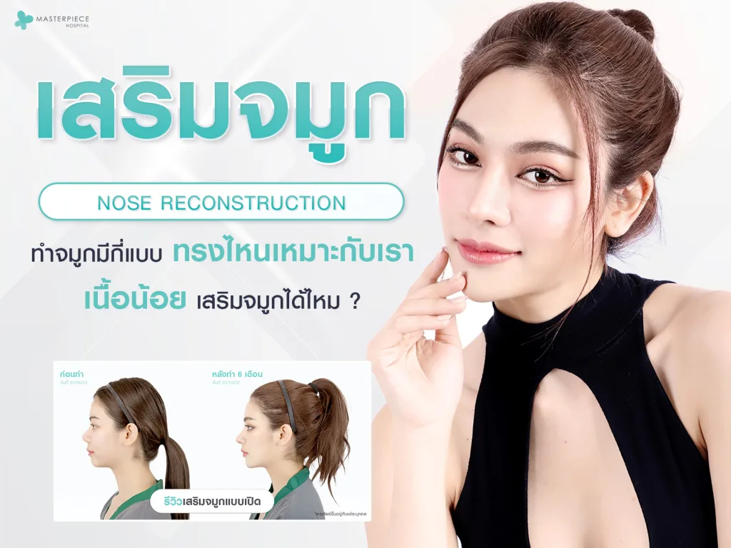 เสริมจมูก