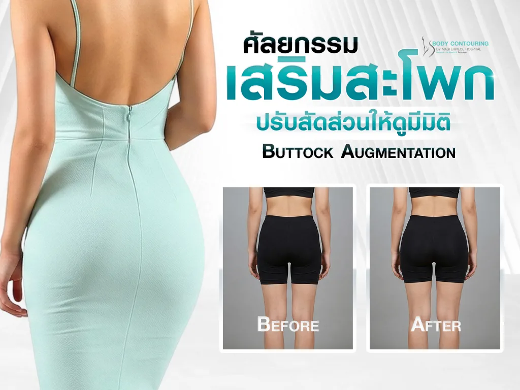 ศัลยกรรมเสริมสะโพก (Buttock Augmentation) ปรับสัดส่วนให้ดูมีมิติ