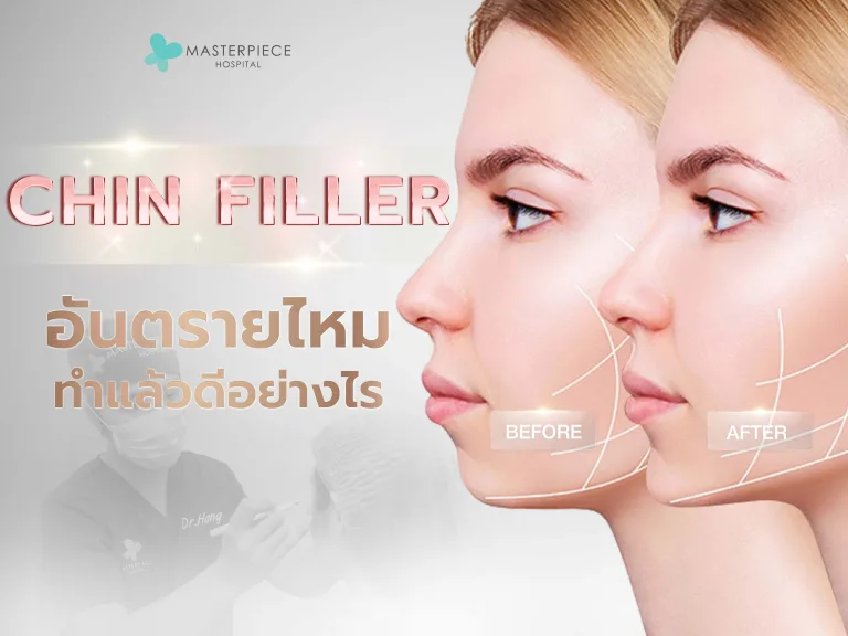 ฟิลเลอร์คางอันตรายไหม ทำแล้วดีอย่างไร