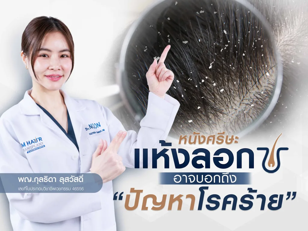 ปัญหาหนังศีรษะคันแห้งลอกอาจบอกถึงโรคร้าย