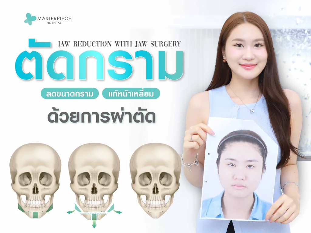 ตัดกรามเป็นหนึ่งศัลยกรรมแก้ไขรูปหน้า หรือที่เรียกอีกอย่างว่า Face design