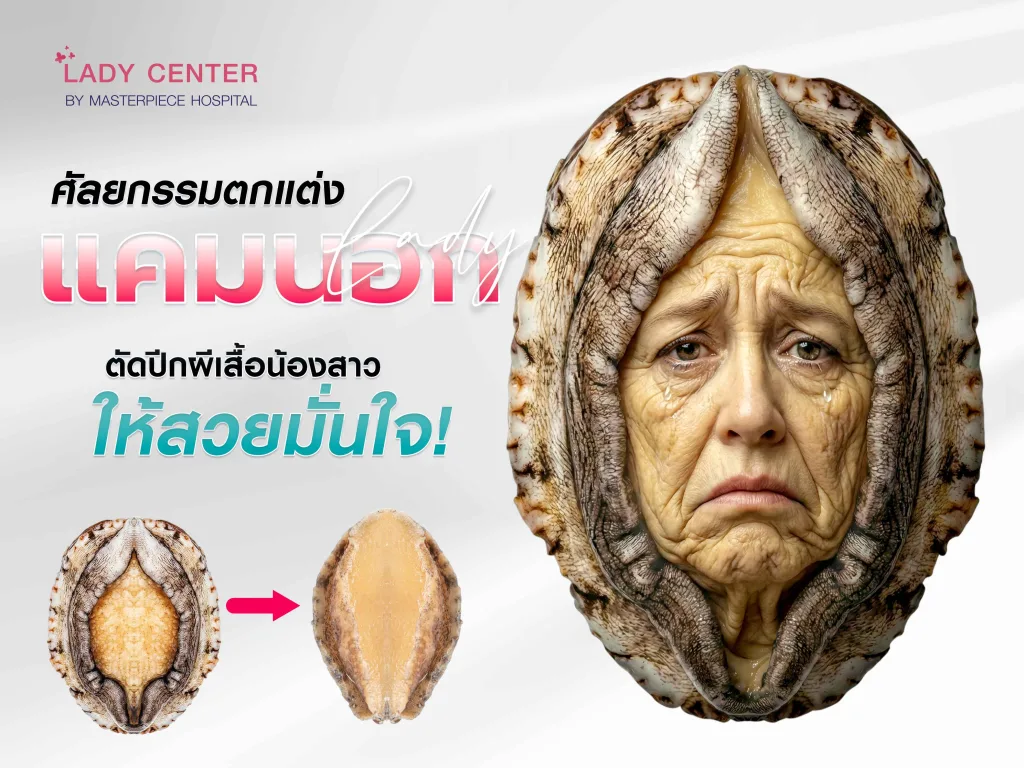 ตกแต่งแคมนอก