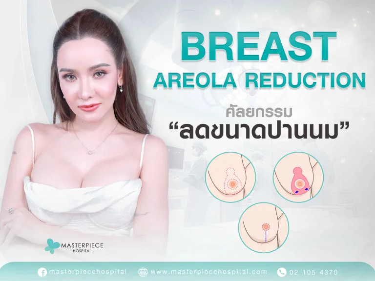 ปัญหาปานนมใหญ่ ผิดรูป ปานนมกว้าง สามารถลดขนาดปานนมได้