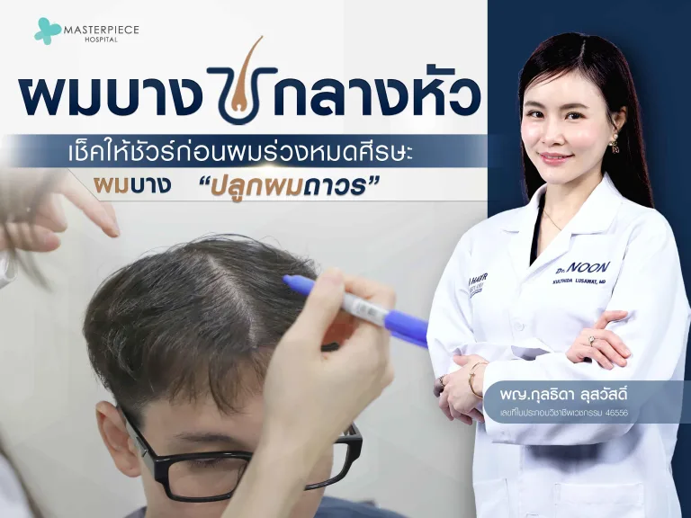 ผมบางกลางหัว