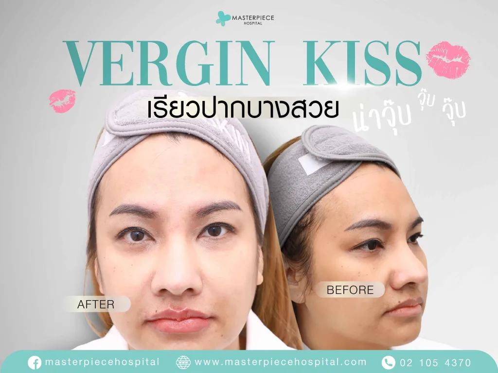 ปากกระจับ ปากบาง ปากปีกนก ช่วยเพิ่มเสน่ห์