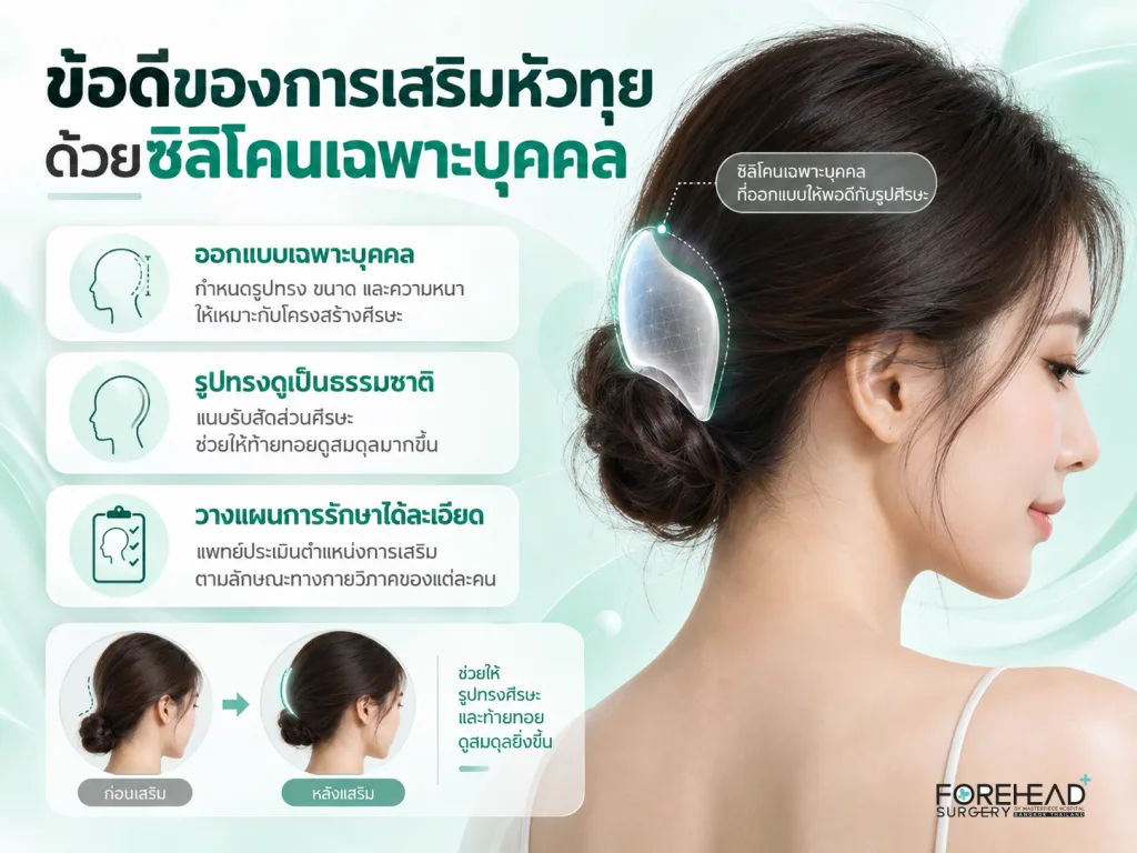 ข้อดีของการเสริมหัวทุยด้วยซิลิโคนเฉพาะบุคคล