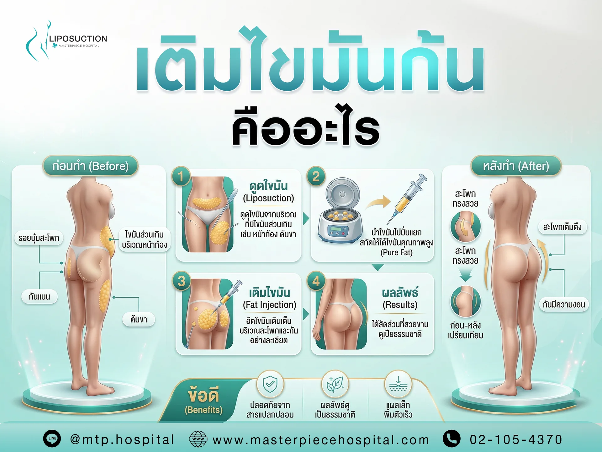 เติมไขมันก้น คืออะไร