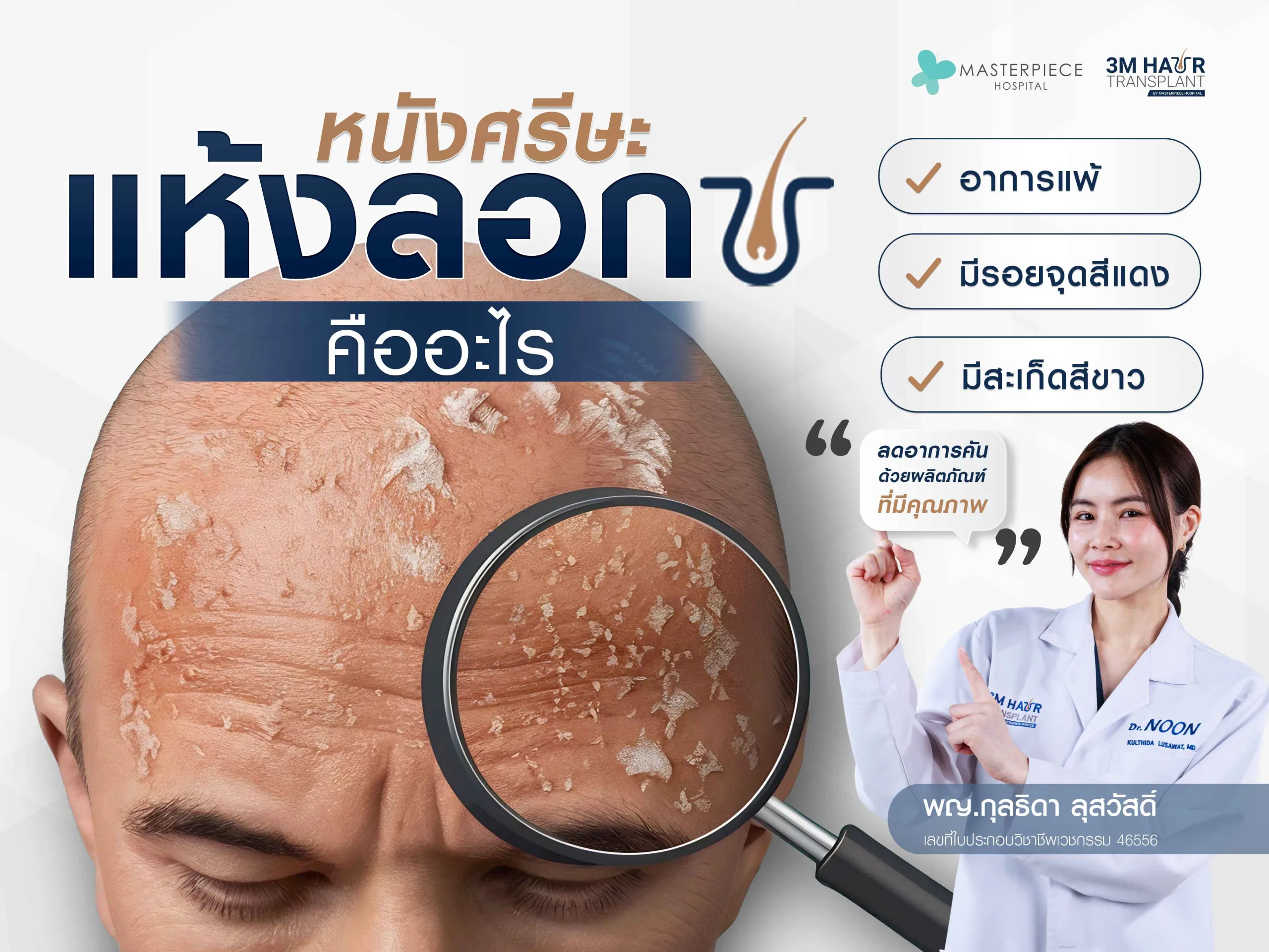 หนังศีรษะแห้งลอกอาจจะเกิดจากอาการแพ้ ซึ่งอาจจะมีทั้งจากแชมพู หรือสภาพแวดล้อมอากาศ