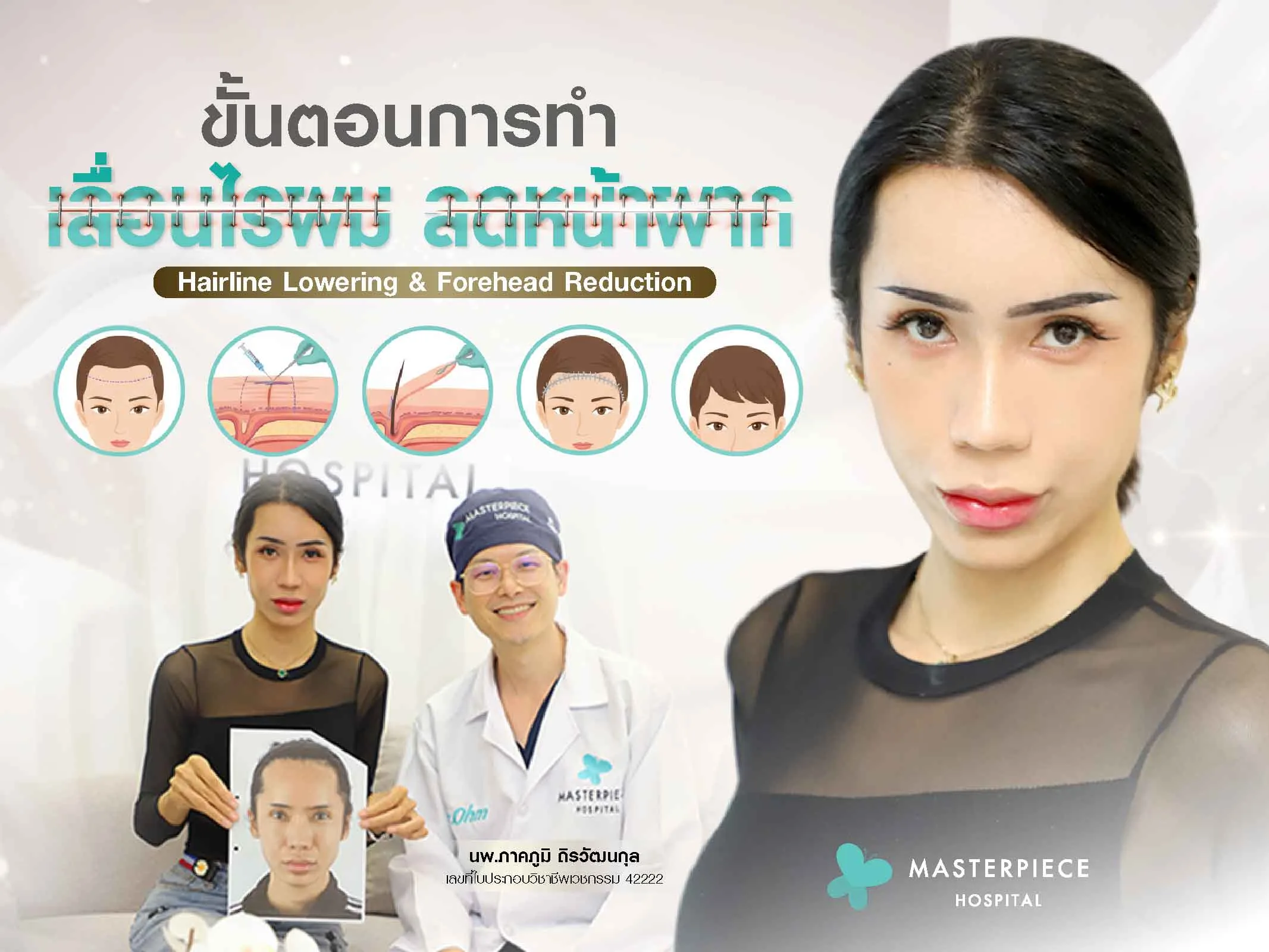 ขั้นตอนการทำ เลื่อนไรผม ลดหน้าผาก