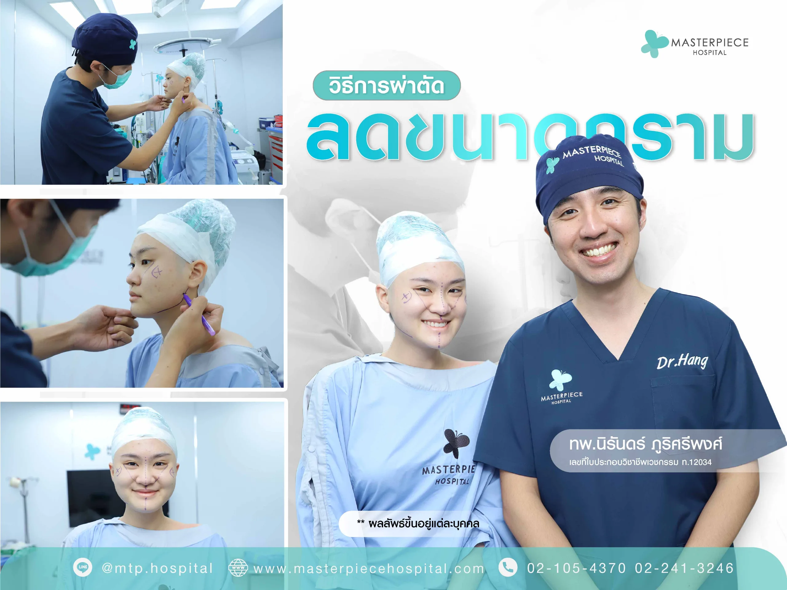 วิธีการผ่าตัดลดขนาดกราม