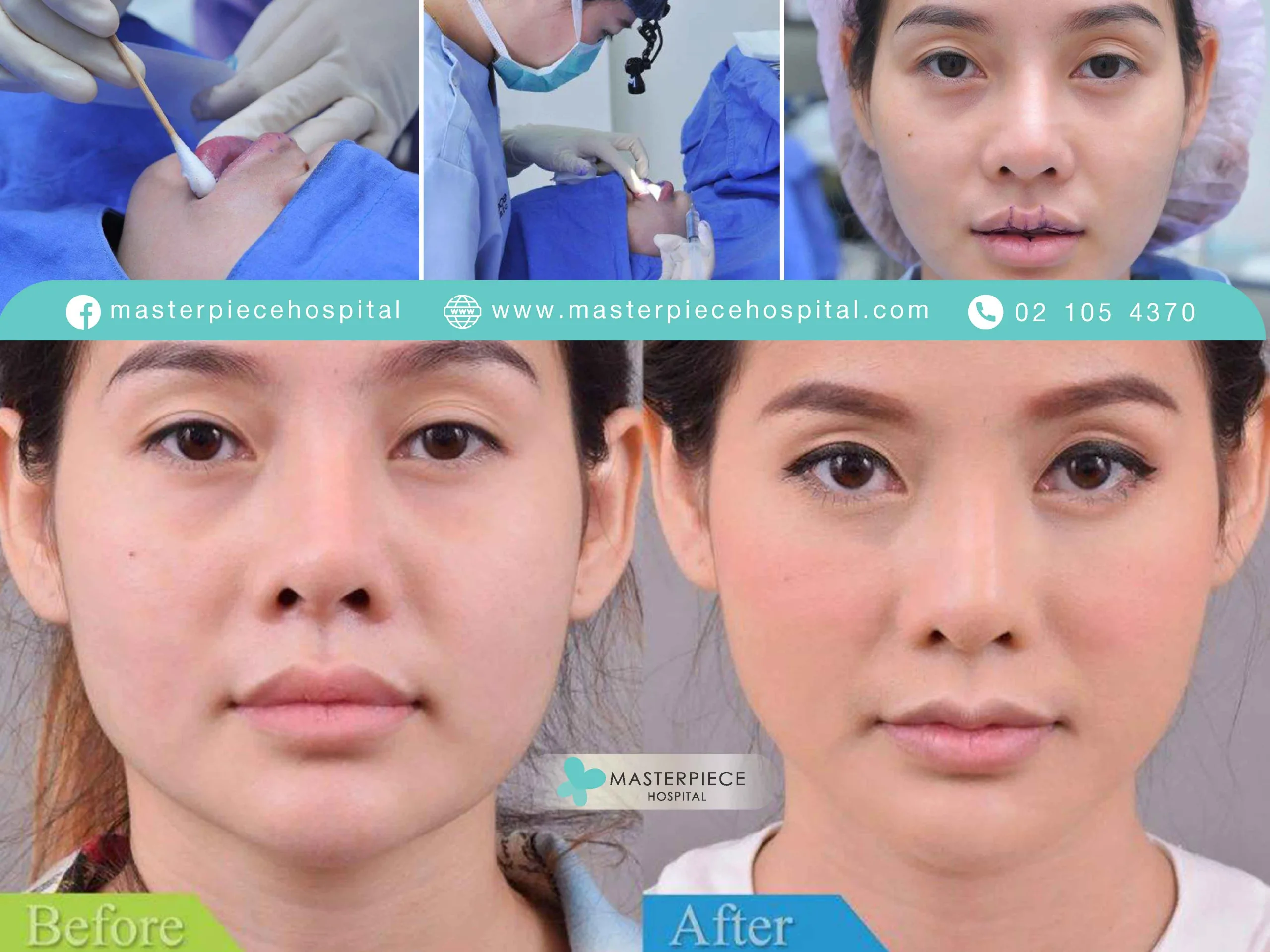 การตกแต่งริมฝีปาก ทำปากกระจับ ปากบาง ปากปีกนก ให้สวยมีเสน่ห์