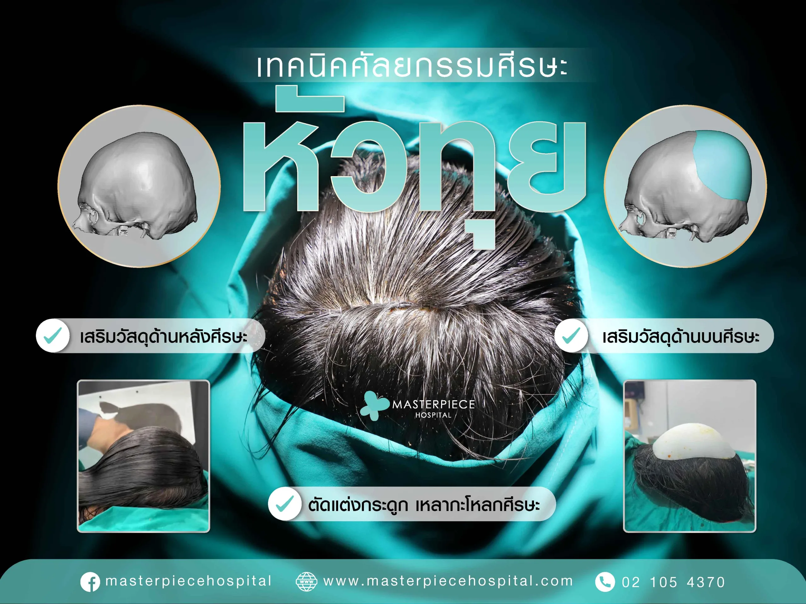เทคนิคศัลยกรรมศีรษะ ตกแต่งกะโหลก