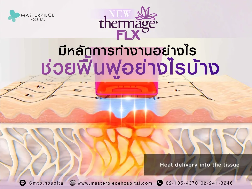 Thermage มีหลักการทำงานอย่างไร