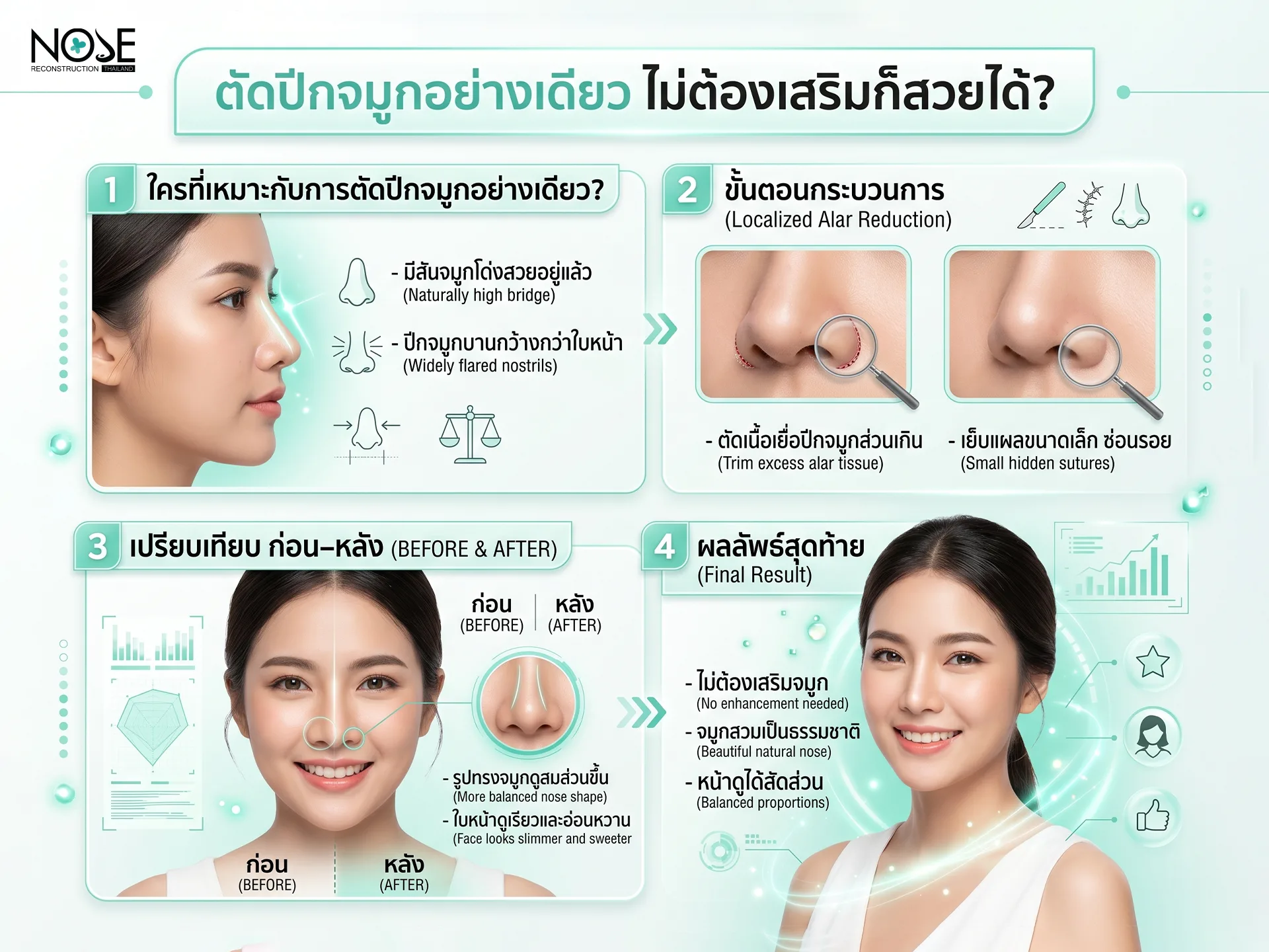 ตัดปีกจมูกอย่างเดียวไม่ต้องเสริมก็สวยได้?