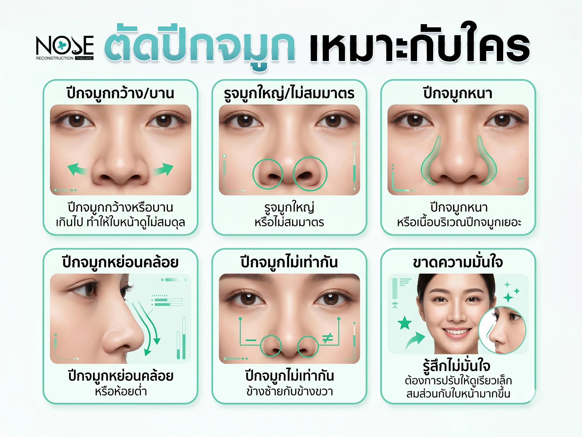 ตัดปีกจมูกเหมาะกับใคร