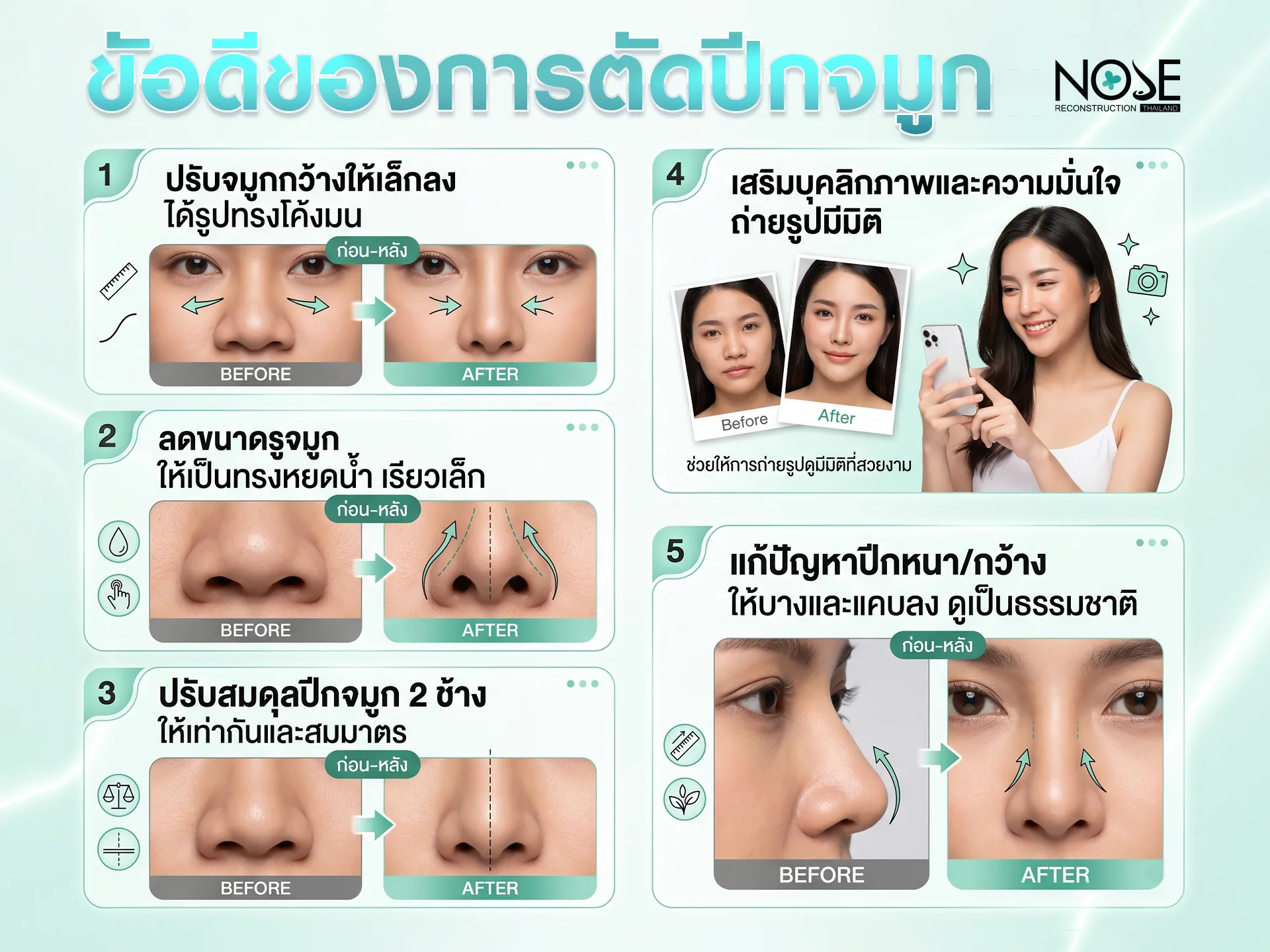 ข้อดีของการตัดปีกจมูก