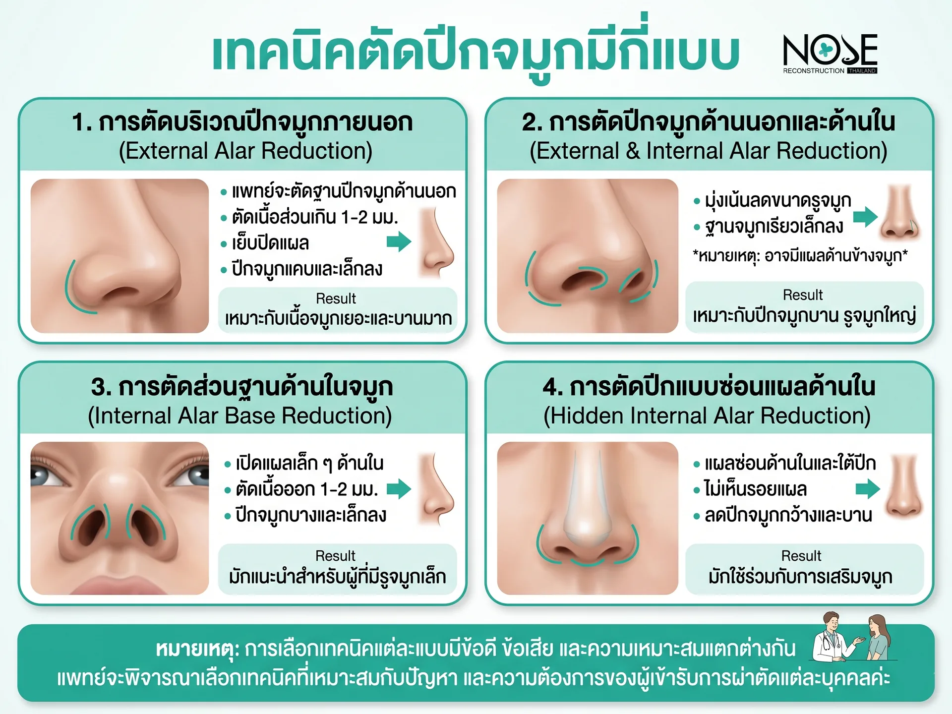 เทคนิคตัดปีกจมูกมีกี่แบบ