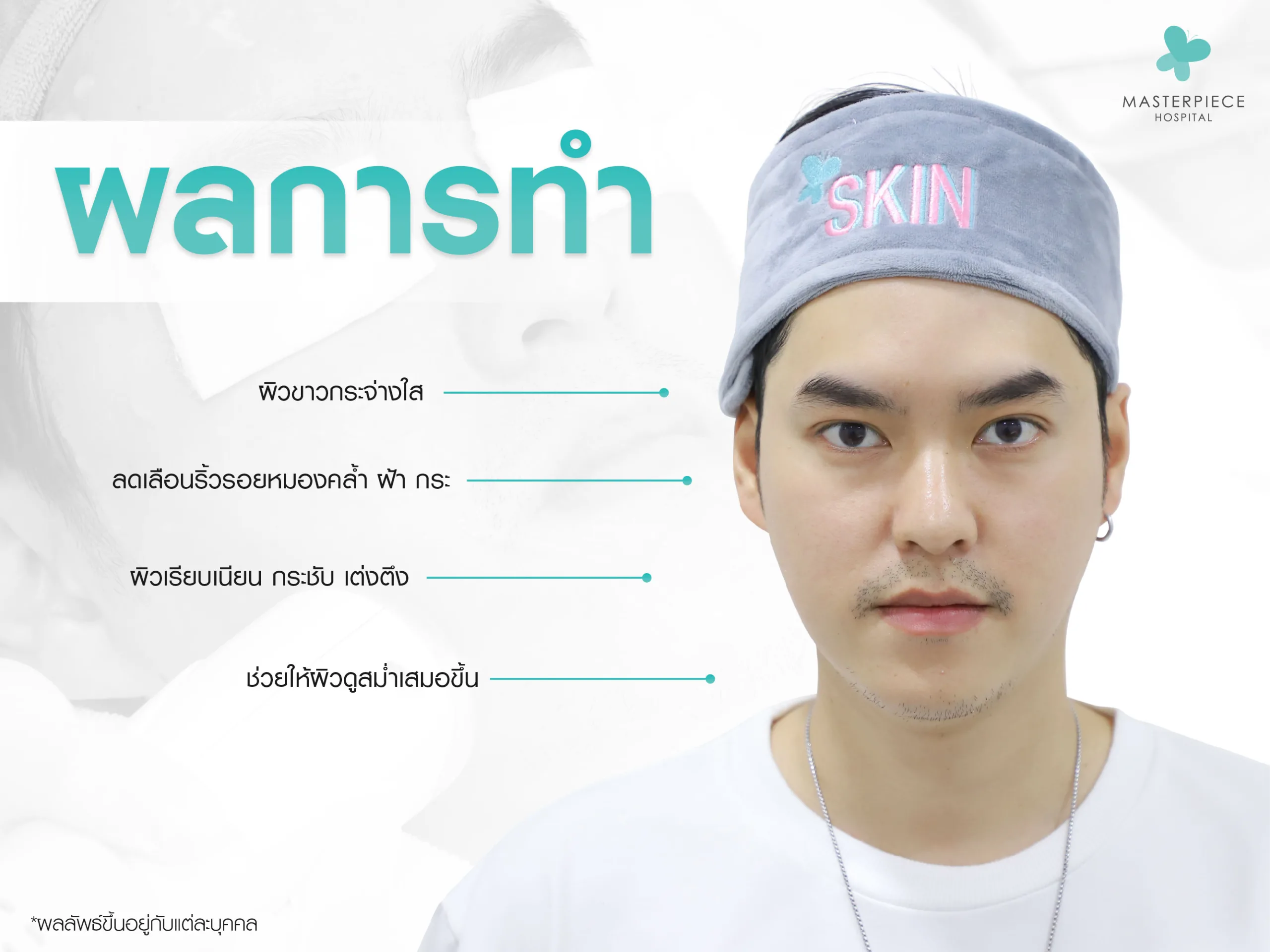 ผลของการทำ Dermis Cool