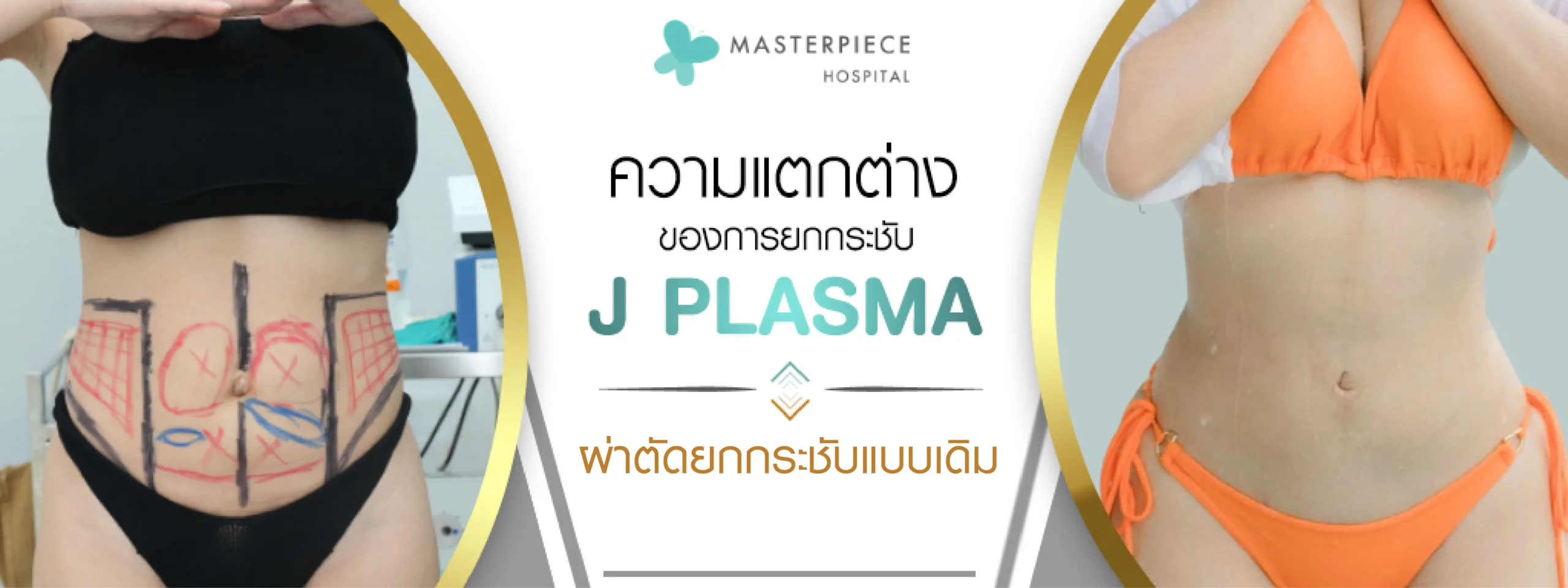 ความแตกต่างของการยกกระชับด้วย J PLASMA กับ การผ่าตัดยกกระชับแบบเดิม ความแตกต่างของการยกกระชับด้วย J PLASMA กับ การผ่าตัดยกกระชับแบบเดิม