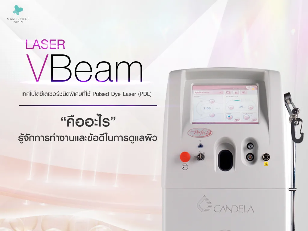เลเซอร์ V Beam คืออะไร รู้จักการทำงานและข้อดีในการดูแลผิว
