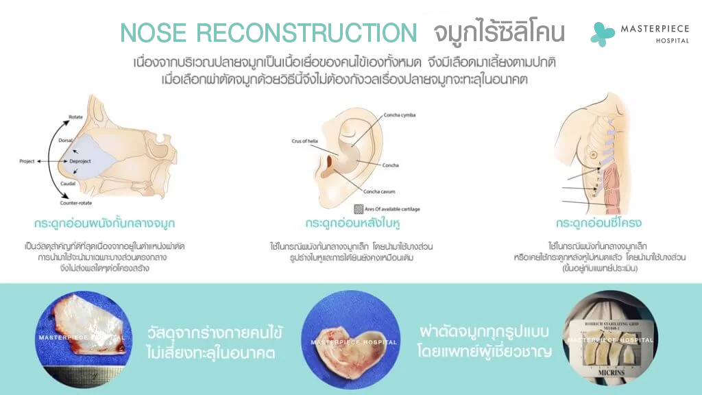 NOSE RECONSTRUCTION จมูกไร้ซิลิโคน