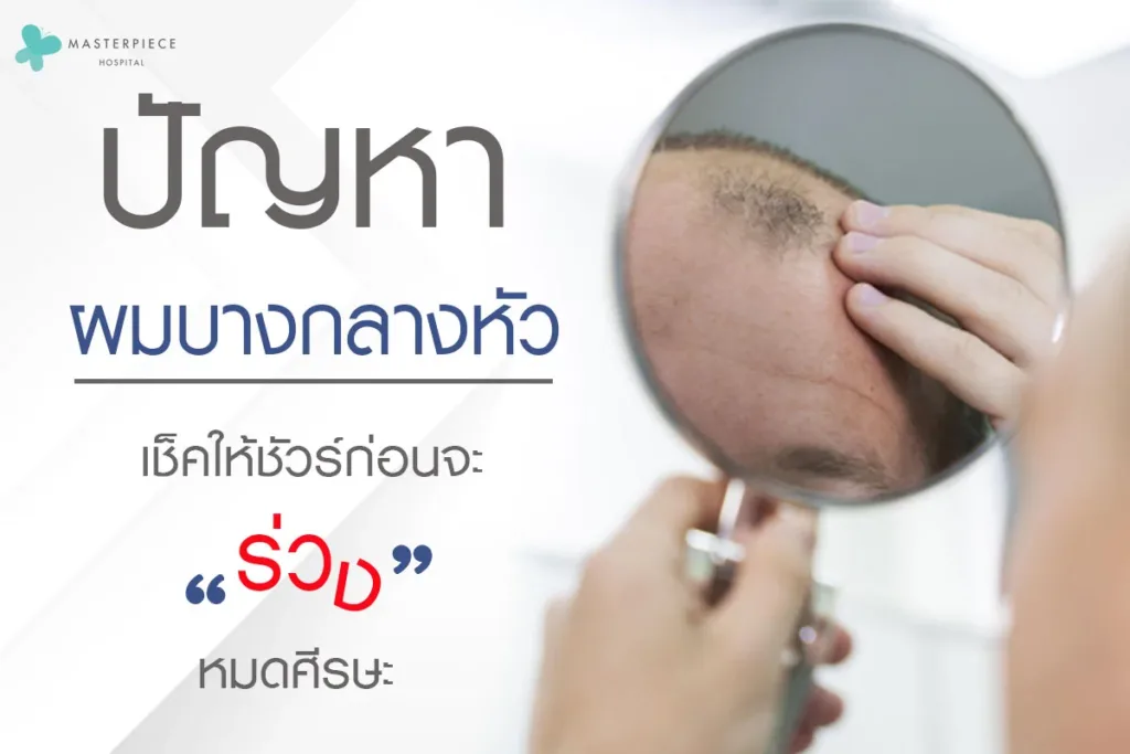 ผมบางกลางหัว