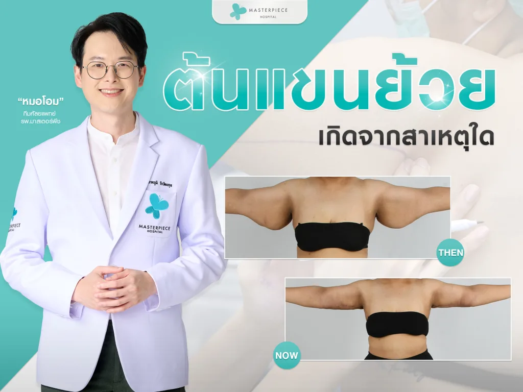 แขนย้วย ต้นแขนใหญ่ เกิดจากอะไร
