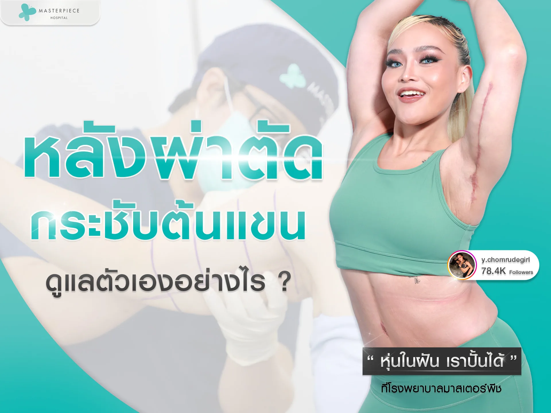 หลังการผ่าตัดแก้แขนย้วย