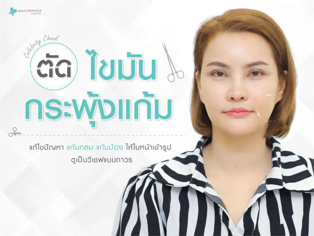 ผู้หญิงหน้าตรง มือซ้ายสัมผัสแก้ม ด้านขวามีกราฟิกเตรียมตัดไขมันกระพุ้งแก้ม